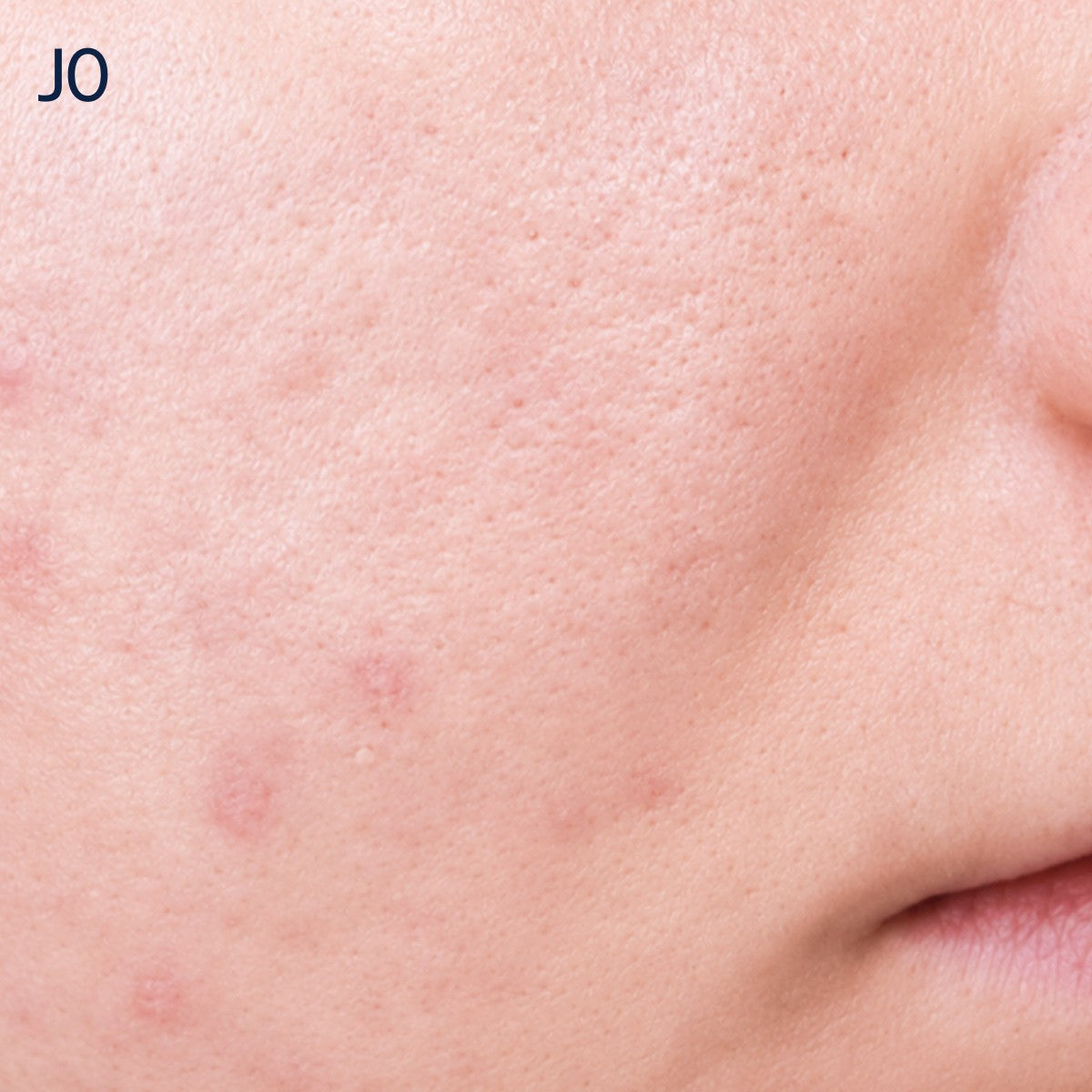 J0