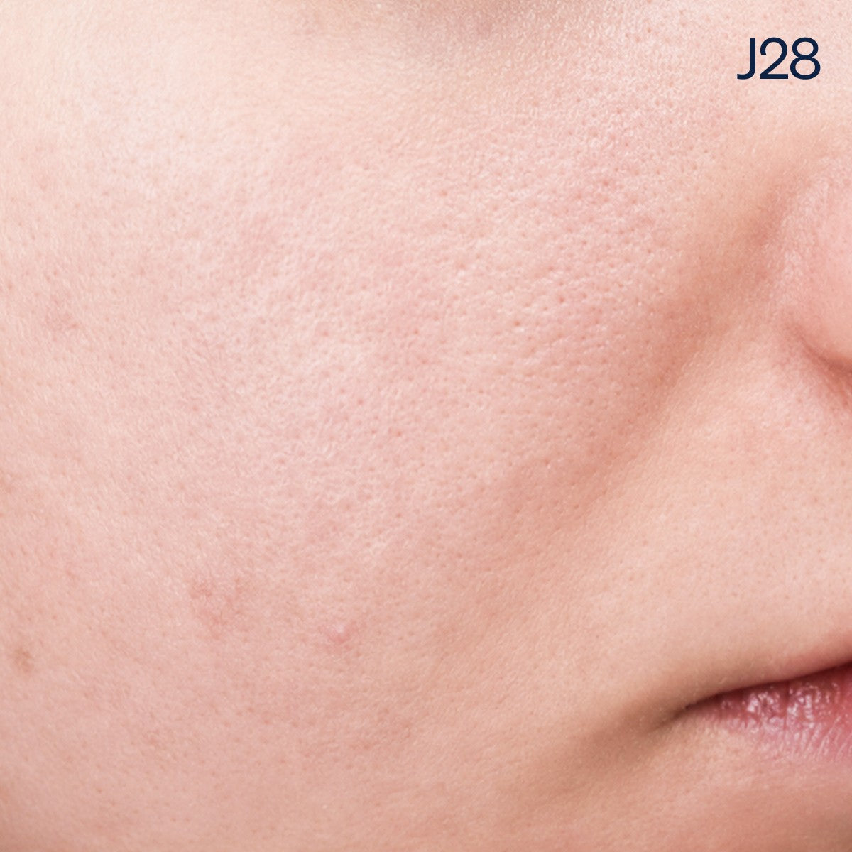 J28